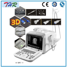 Портативное ультразвуковое диагностическое оборудование (THR-US6602)